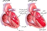 كلاس آموزش همگاني با موضوع نارسايي قلبي و رژيم غذايي مناسب